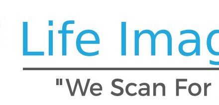 Life Imaging Fla on Building Something Different in a Reactive Industry